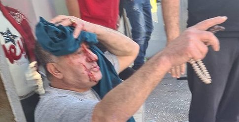 3 إصابات بانفجار داخل مطعم في القدس المحتلة