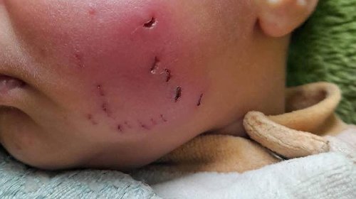 الجرذان والحشرات تغزو خيام ومنازل غزة.. كارثة بيئية تنهش أجساد النازحين