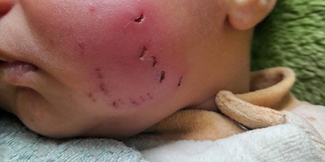 الجرذان والحشرات تغزو خيام ومنازل غزة.. كارثة بيئية تنهش أجساد النازحين