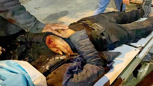 3 شهداء في مجزرة إسرائيلية جديدة استهدفت محيط المسلخ التركي بخان يونس