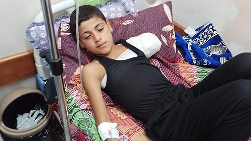 الصحة بغزة تصدر بياناً بعد بتر يد طفل نتيجة خطأ طبي